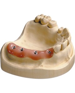 Implant-Mask+15ml Trennmittel