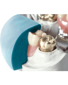 dentona gum 85 Eimer 10kg